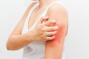skin derma