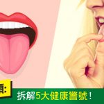 觀察舌頭