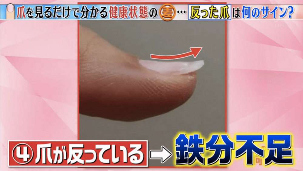 教你分辦6個常見指甲健康徵兆-指甲有黑點-癌症-13