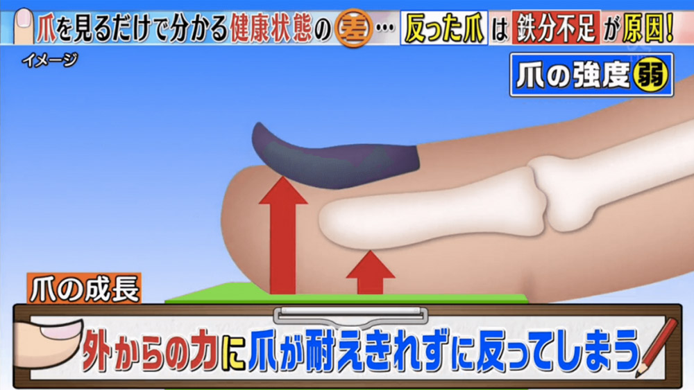 教你分辦6個常見指甲健康徵兆-指甲有黑點-癌症-15