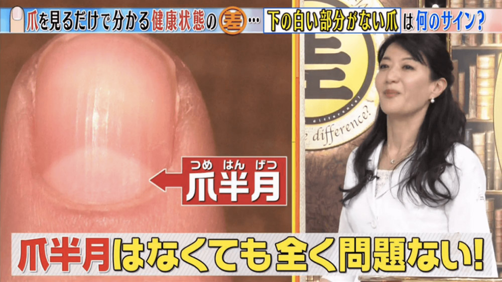 教你分辦6個常見指甲健康徵兆-指甲有黑點-癌症-18