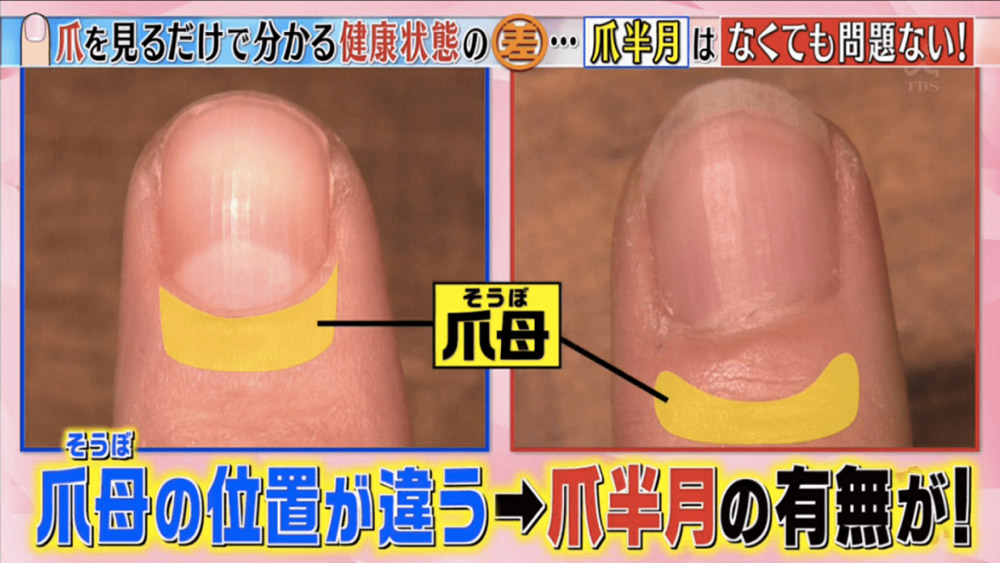 教你分辦6個常見指甲健康徵兆-指甲有黑點-癌症-19