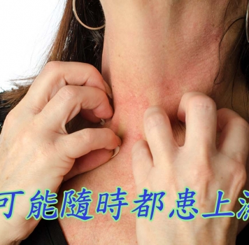 湿疹知识