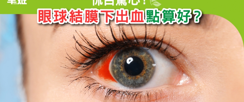 怵目驚心！眼球結膜下出血點算好？