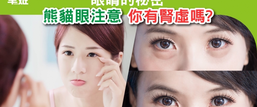 眼睛的秘密  熊貓眼注意，你有腎虛嗎?