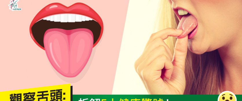 觀察舌頭: 拆解5大健康警號